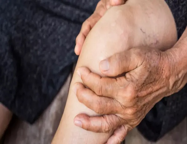 علاج الروماتيزم بالأعشاب من المنزل بوصفات طبيعية