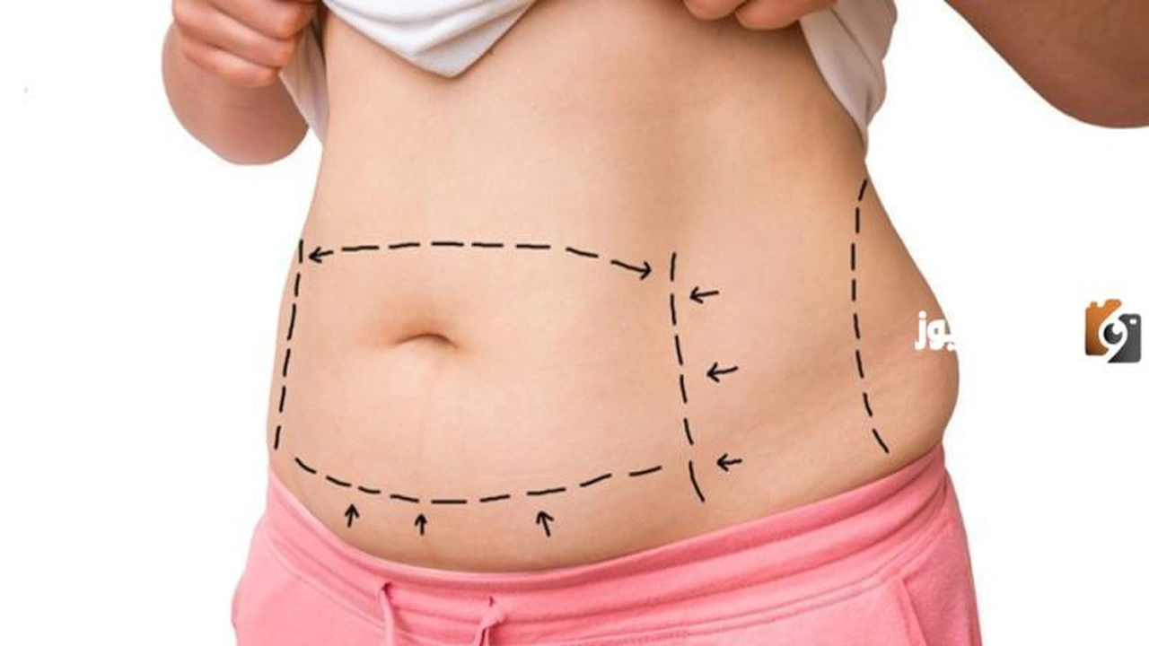 ريجيم الولادة الطبيعية لشد البطن    