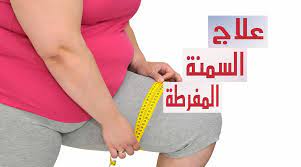 علاج السمنة المفرطة بسرعة