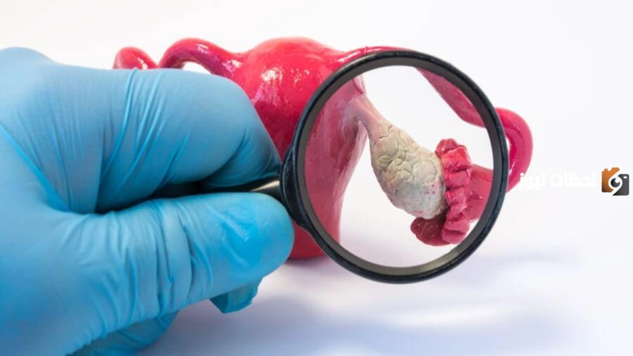 هل الكيس على المبيض يسبب نزول دم؟    