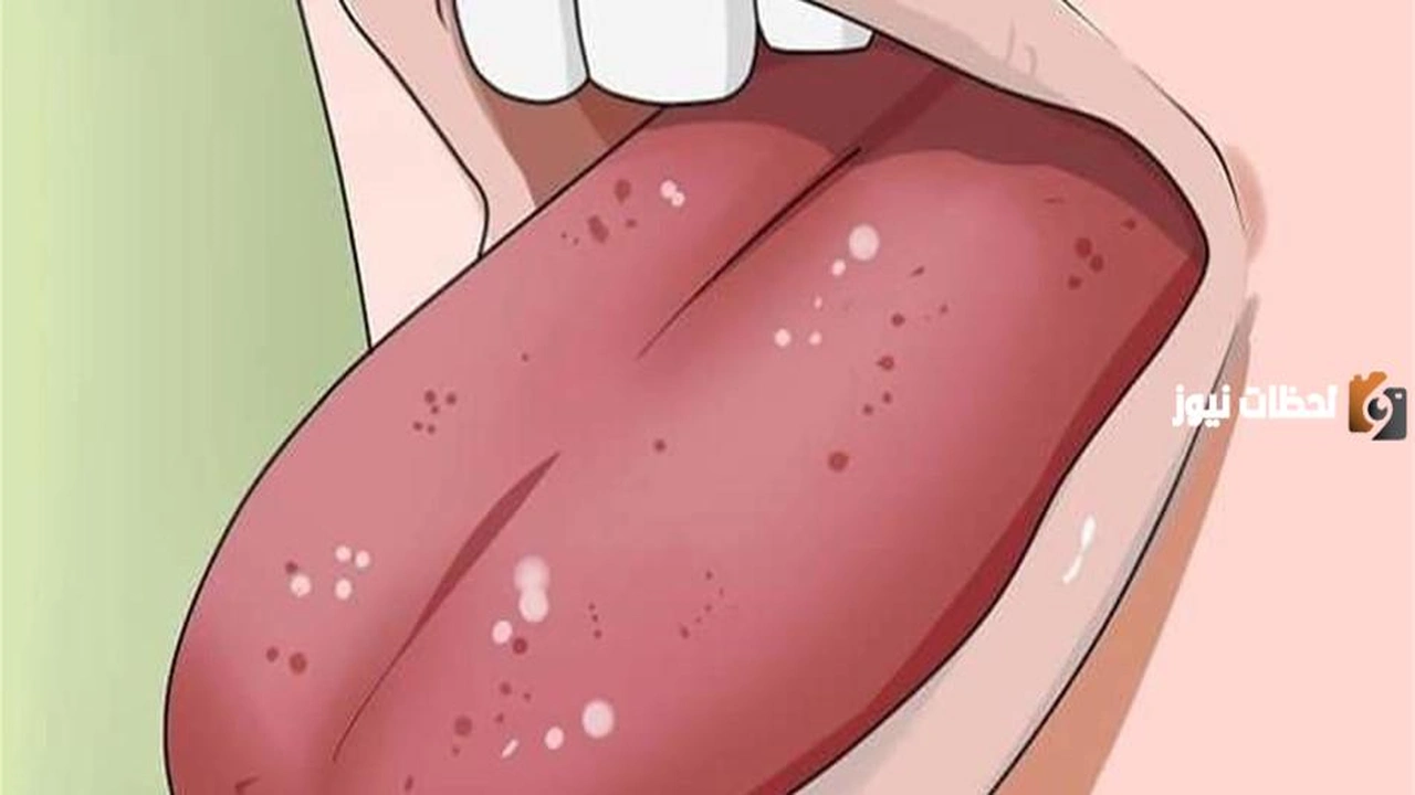 هل يُقطّب اللسان؟ وكيفية علاج جرح اللسان؟    